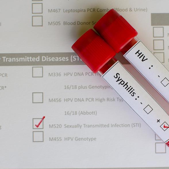 STD test